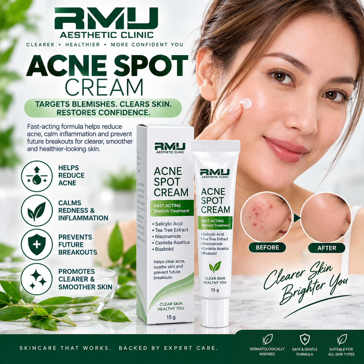 Acne Spot Cream